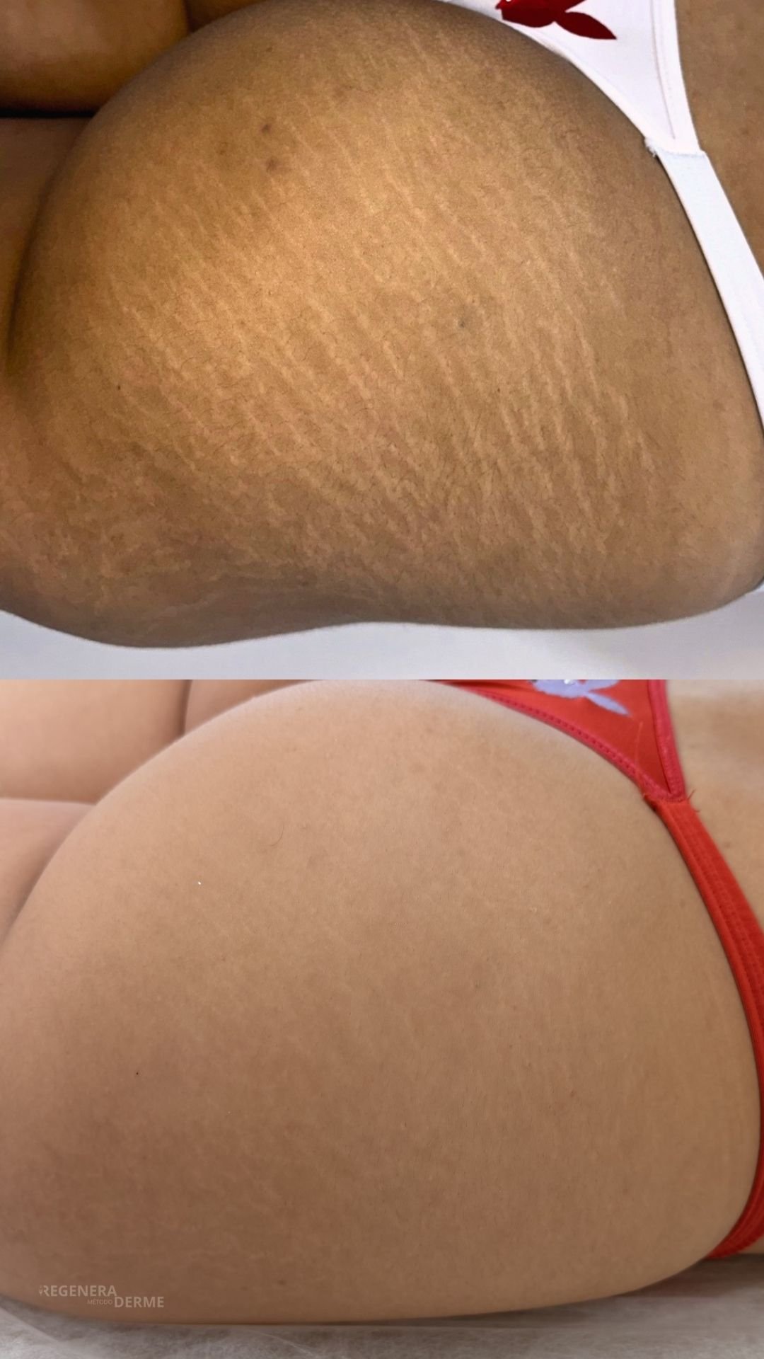 Mais uniformidade na pele